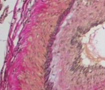 Arterie (EVG)
